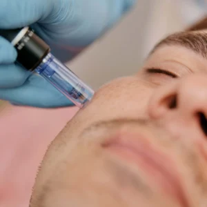 Collagen P.I.N.® Microneedling Device
